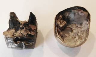 金属が外れた方の例